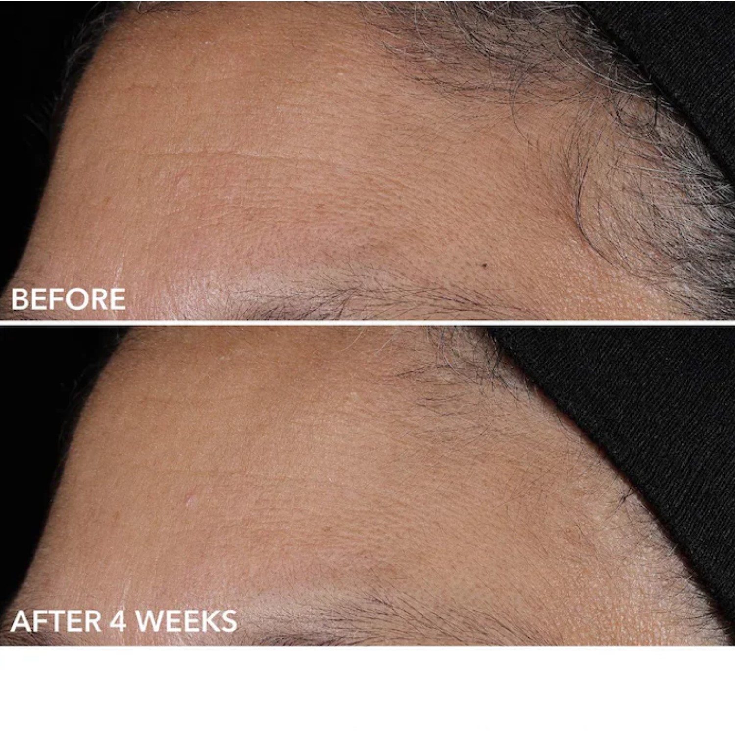 ADVANCED RETINOL + FERULIC PERFECTLY DOSED RETINOL EXTRA STRENGTH 0.5% (ALMOHADILLAS EXFOLIANTES CON RETINOL)